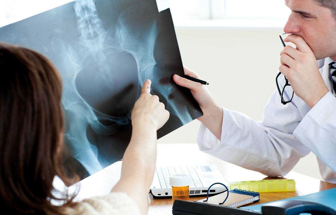 artsen die röntgenfoto's onderzoeken voor heupartrose