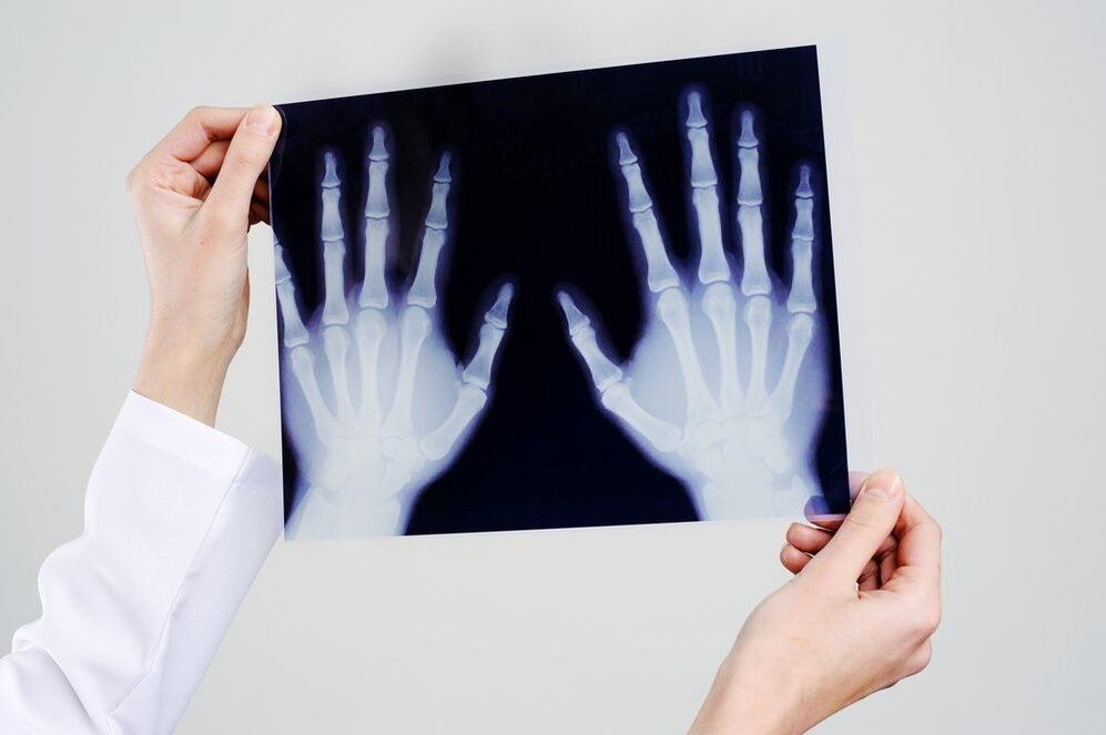 diagnostiek van handgewrichten